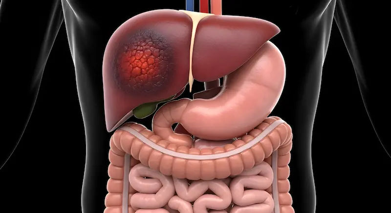 New Paradigms in Pancreas Surgery Safer, Smarter Care